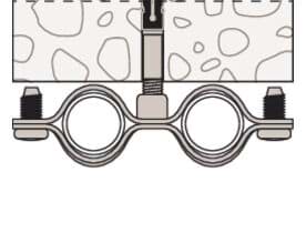 Bild von Schraubabstandsschelle AMD